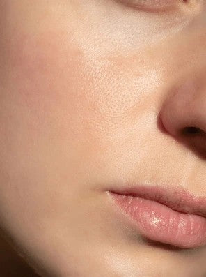 image comparison after