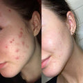 Retinol Mushroom Serum - GlowNestpk.com